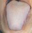 Diagnóstico por la lengua pálida según la Medicina China